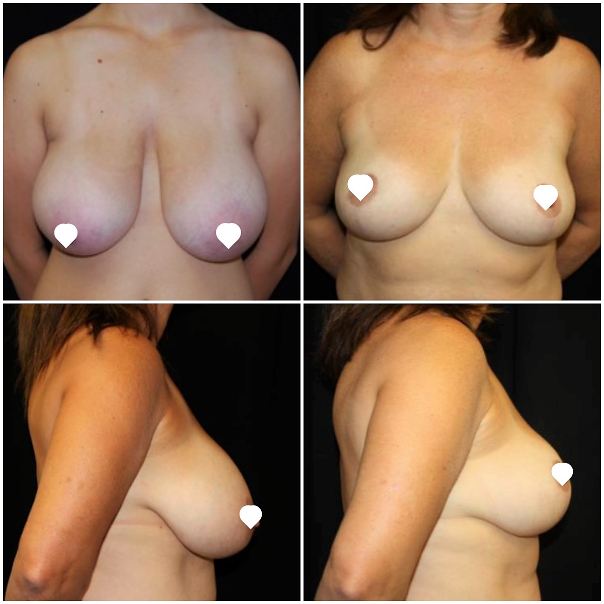 FotoJet 2022 01 19T220144.269 β 2